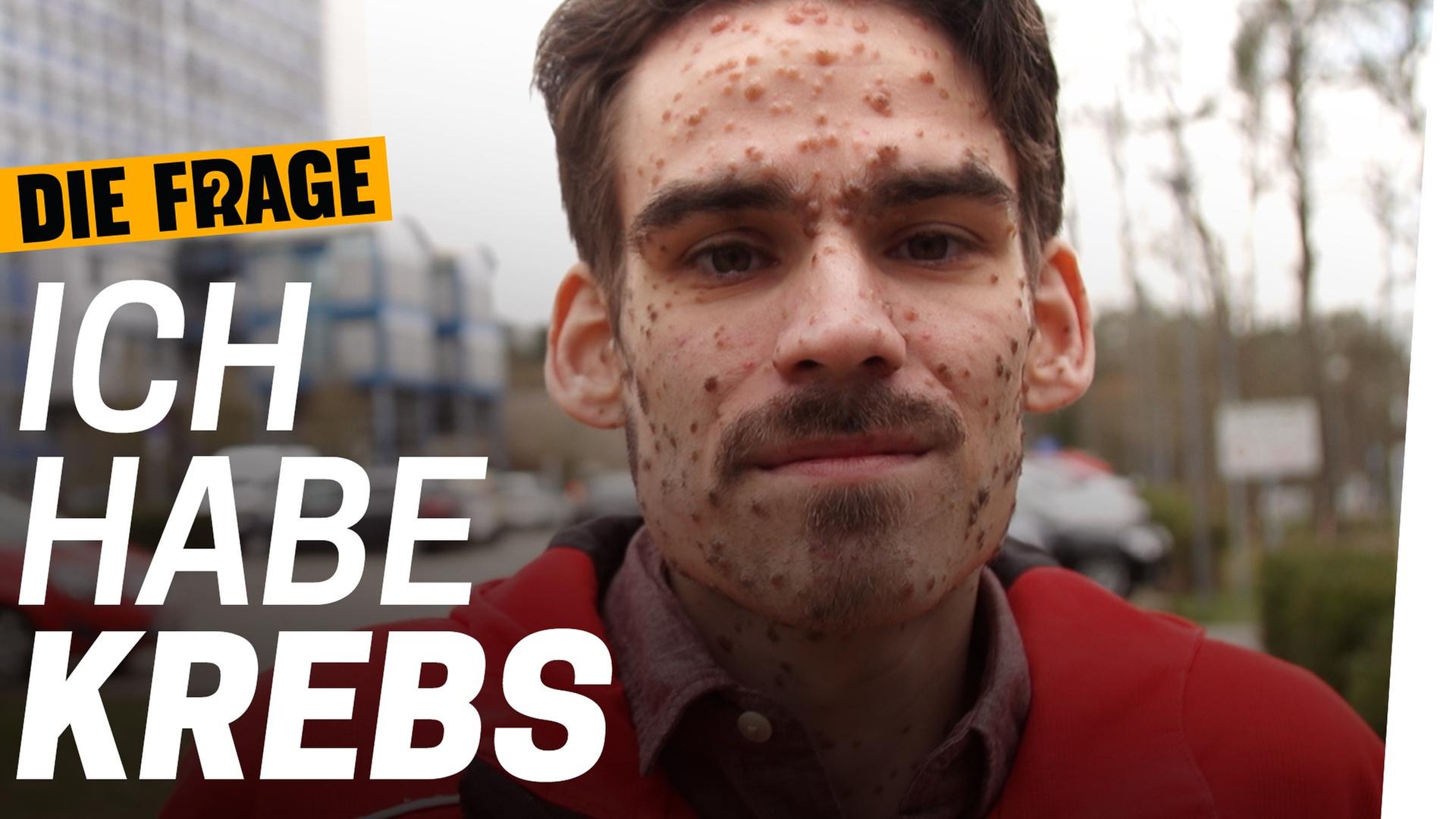 Plötzlich Krebs: Wie geht man damit um? - Wie lebe ich mit einer schweren Krankheit? Folge 1