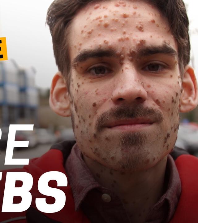 Plötzlich Krebs: Wie geht man damit um? - Wie lebe ich mit einer schweren Krankheit? Folge 1