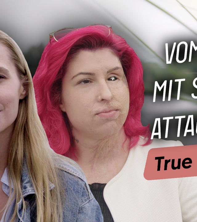 Säure-Angriff überlebt: Wie Vanessa nach der Attacke zu sich selbst fand