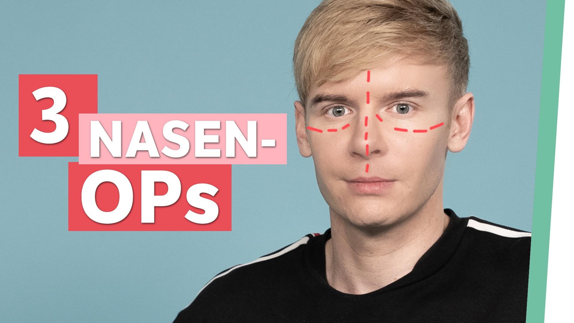 Schönheits-OP: Ich bereue die Entscheidung! - Auf Klo