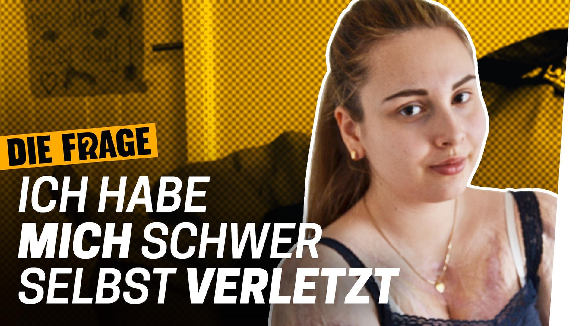 Selbstverletzung: Ich wollte meinen Körper zerstören - Wie komme ich mit meinem Körper klar Folge 3