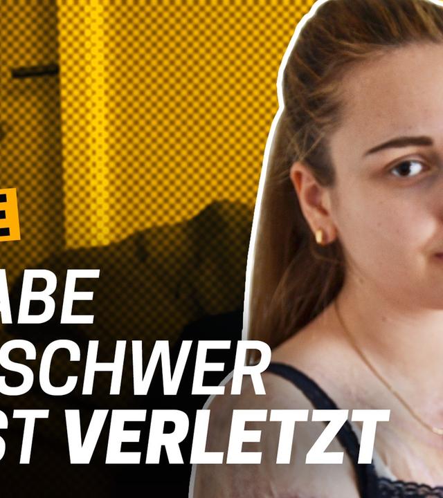 Selbstverletzung: Ich wollte meinen Körper zerstören - Wie komme ich mit meinem Körper klar Folge 3