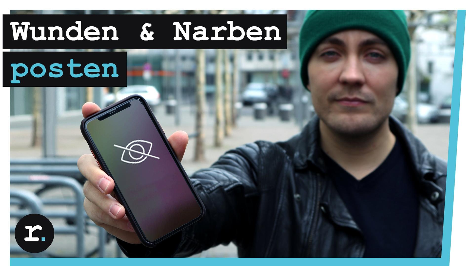 Selbstverletzung: Schmerzen zeigen bei Instagram