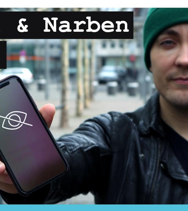 Selbstverletzung: Schmerzen zeigen bei Instagram