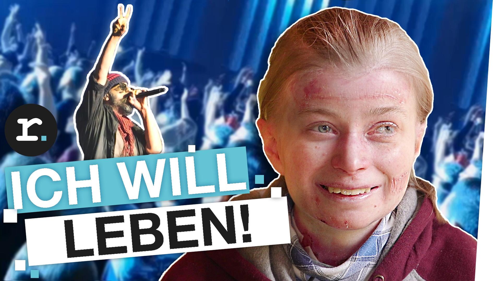 Seltene Hautkrankheit: Wenn Wunden zum Leben gehören - reporter