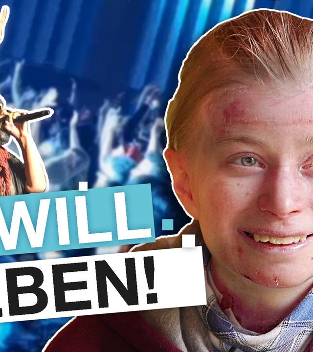 Seltene Hautkrankheit: Wenn Wunden zum Leben gehören - reporter