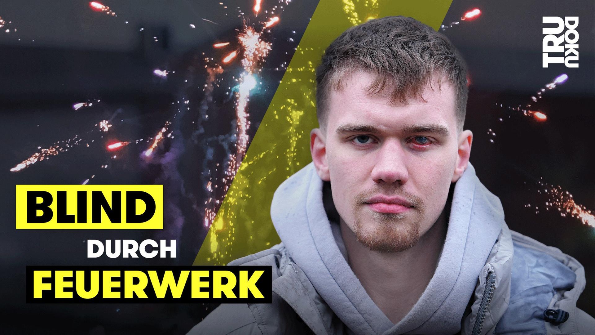 Silvester-Albtraum: Lucas (19) von Feuerwerk getroffen - TRU DOKU