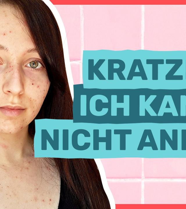 Skinpicking: Krankhaft Pickel ausdrücken - Auf Klo