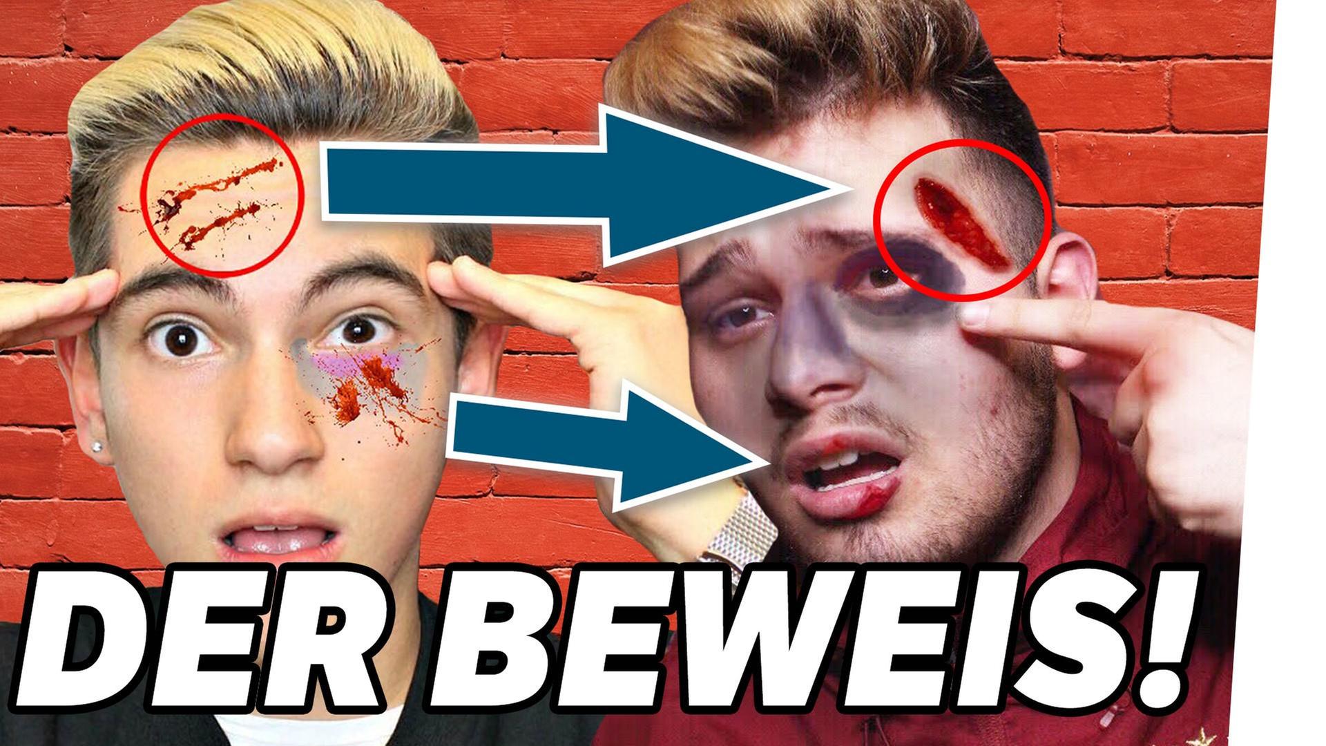 Steckt ER hinter dem MORDANSCHLAG gegen Dennis?! ? - CLICKBAIT des MONATS