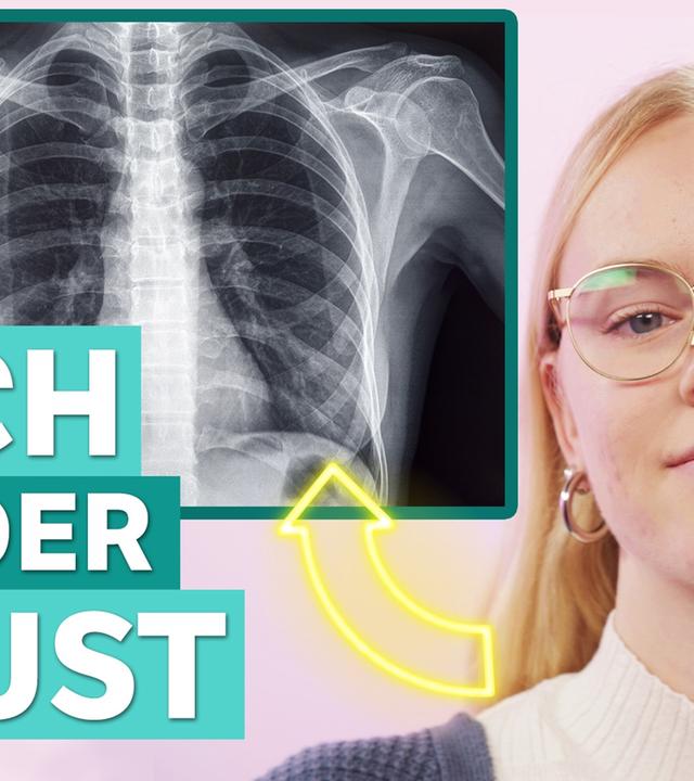 Trichterbrust: Meine Brust wuchs nach innen - Auf Klo