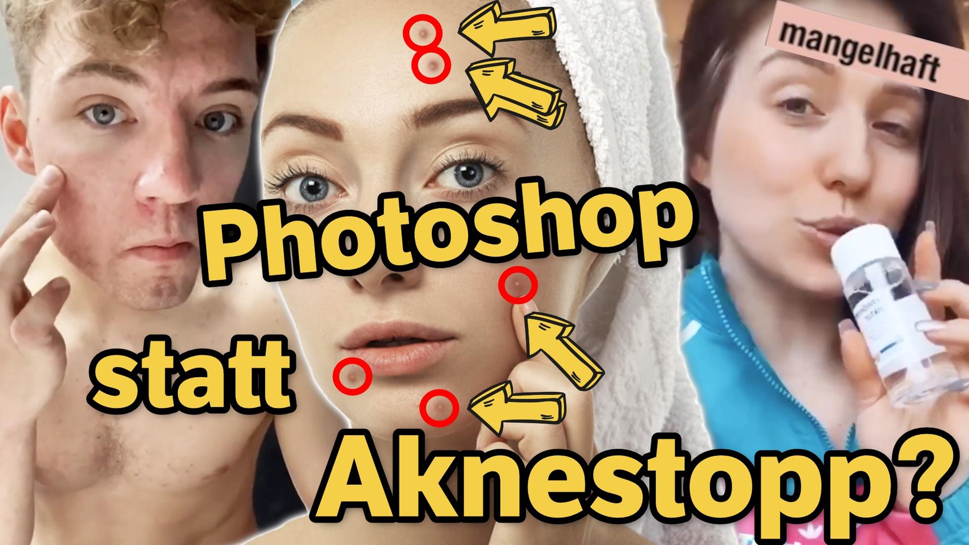 Trotz TikTok-Hype: Aknederm MANGELHAFT?! Warum Bibi & die Lochis die Salbe (trotzdem) lieben!