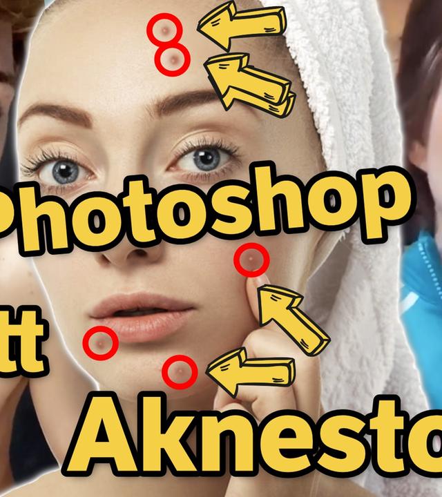 Trotz TikTok-Hype: Aknederm MANGELHAFT?! Warum Bibi & die Lochis die Salbe (trotzdem) lieben!