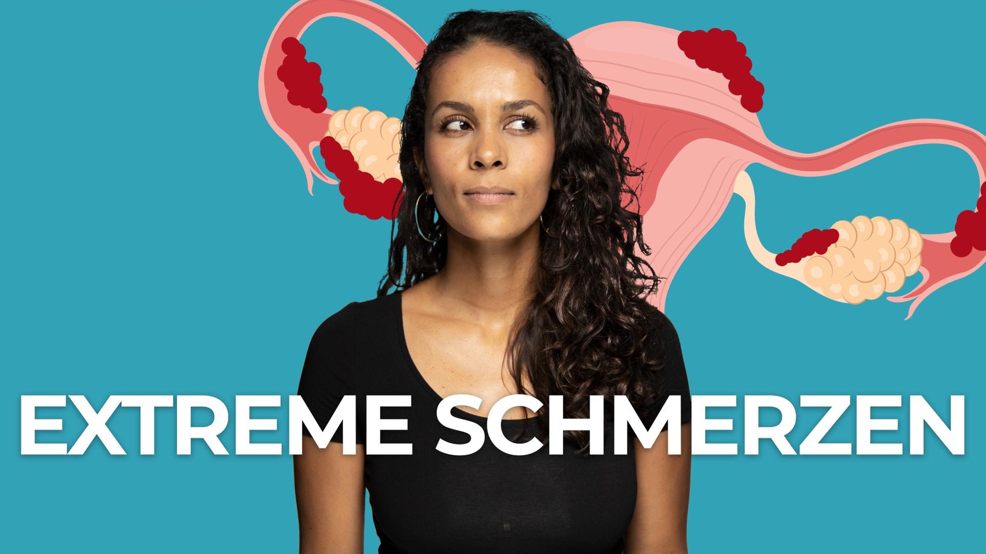 Unfruchtbar durch Endometriose?