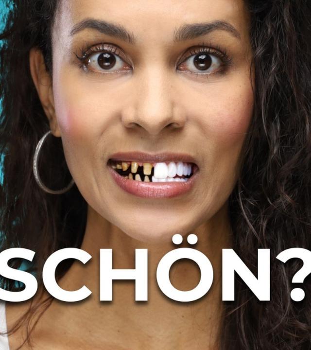 Wie gefährlich Veneers wirklich sind