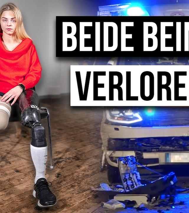 Wie ist das BEIDE BEINE ZU VERLIEREN?