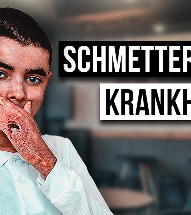 Wie ist das DIE SCHMETTERLINGSKRANKHEIT ZU HABEN?