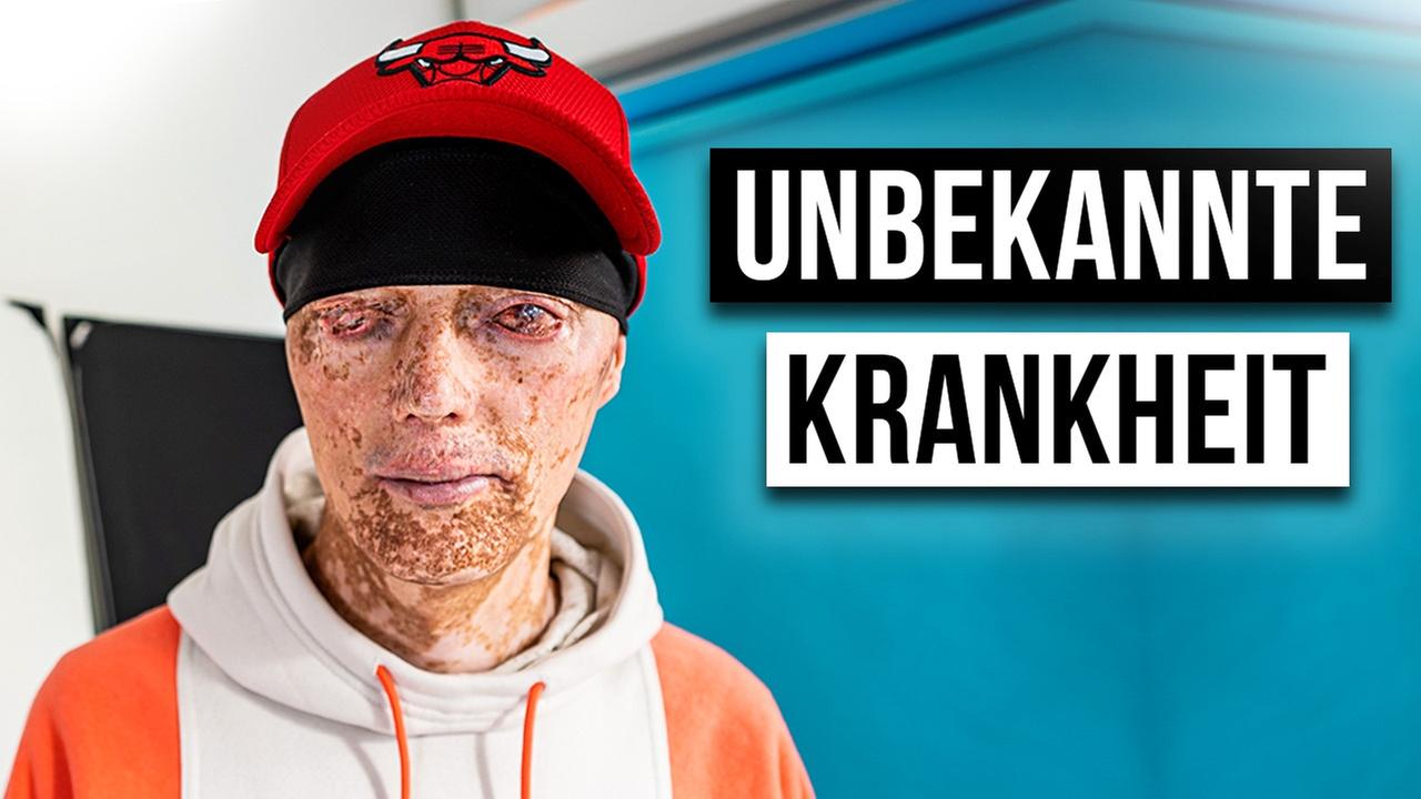 Wie ist das EINE UNBEKANNTE KRANKHEIT ZU HABEN?