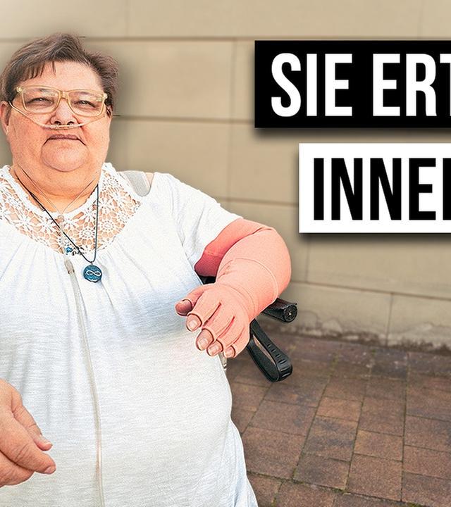 Wie ist das LIPÖDEM ZU HABEN?