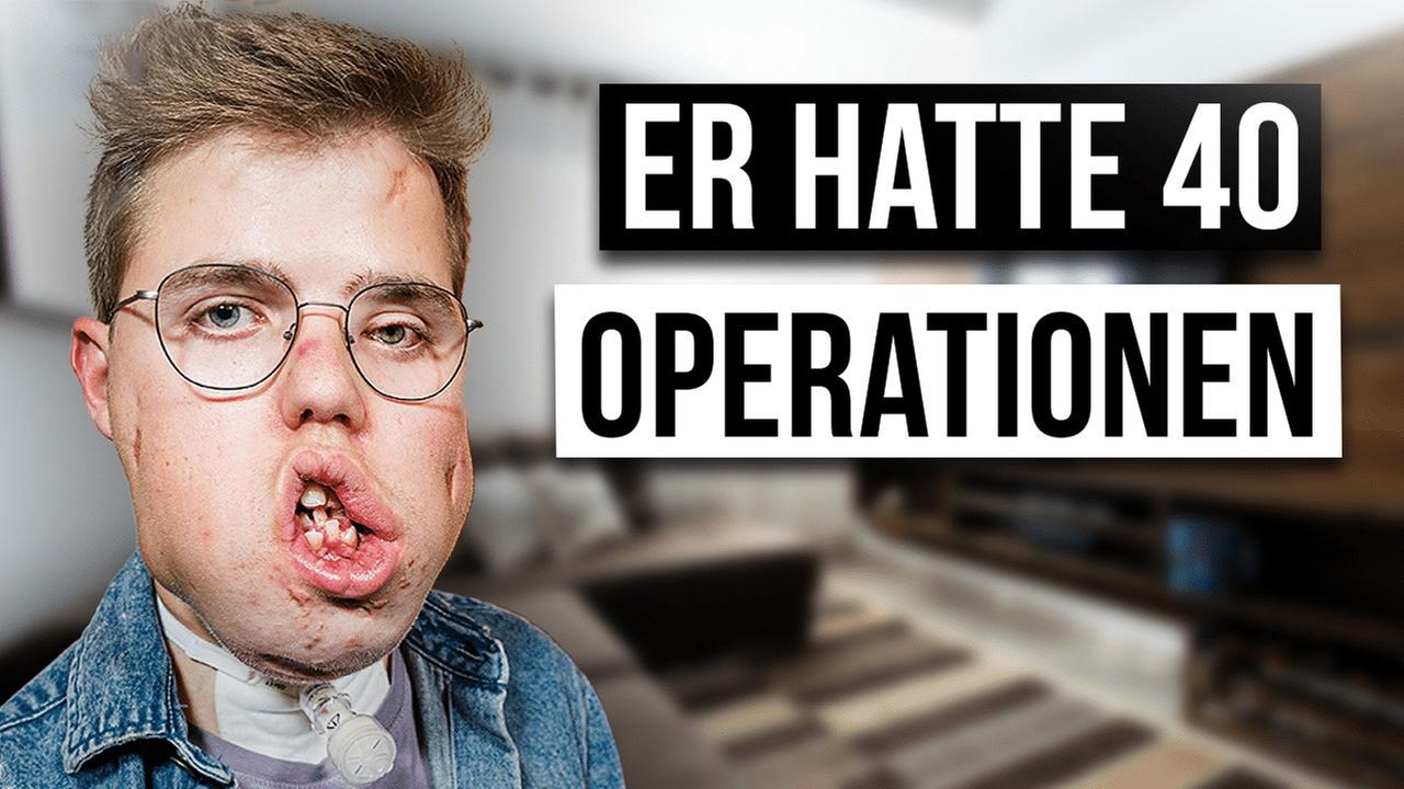 Wie ist das LYMPHANGIOM ZU HABEN?