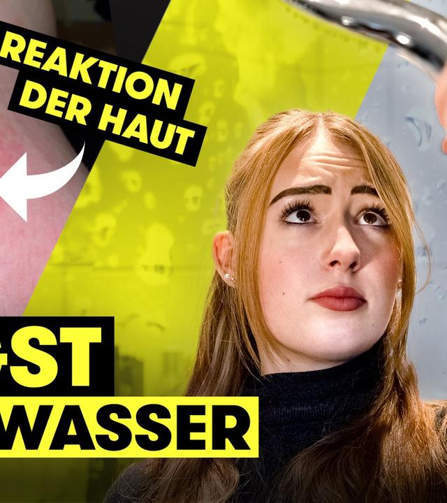 Wie ist das möglich?! Mercedés (18) kriegt Ausschlag von Wasser I TRU DOKU
