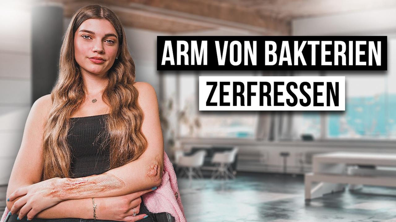 Wie ist das MORBUS CROHN ZU HABEN?