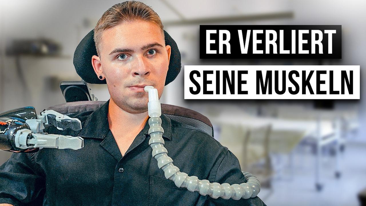 Wie ist das MUSKELDYSTROPHIE ZU HABEN?