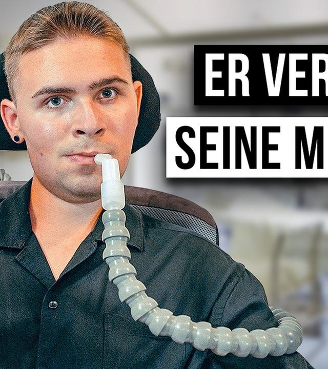 Wie ist das MUSKELDYSTROPHIE ZU HABEN?