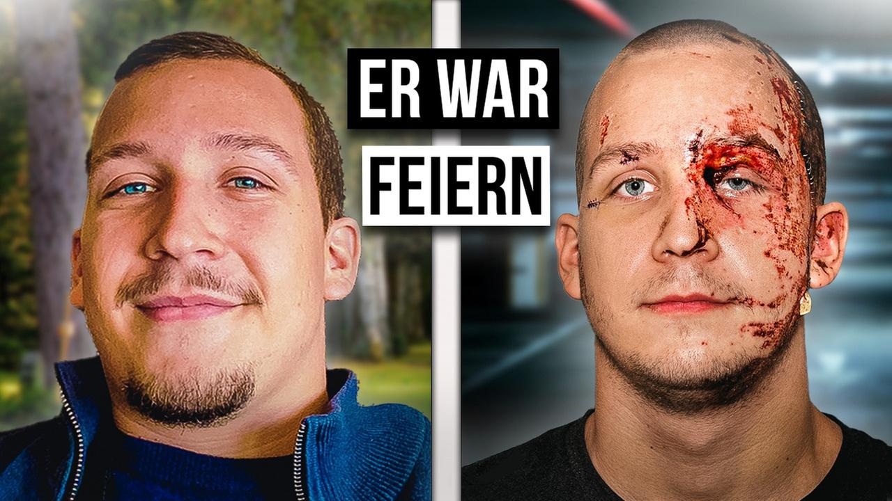 Wie ist das OPFER EINES SÄUREANGRIFFS ZU SEIN?