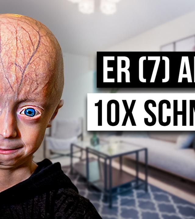 Wie ist das PROGERIE ZU HABEN?