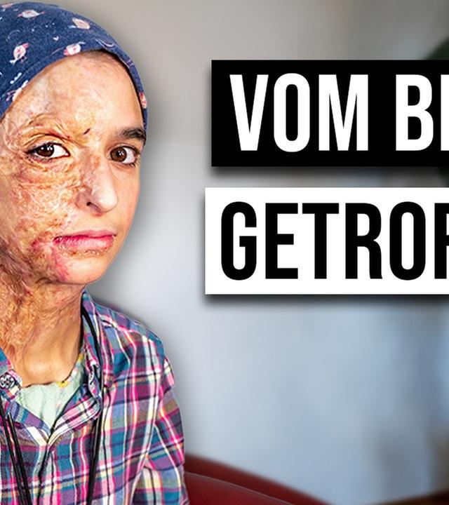 Wie ist das VOM BLITZ GETROFFEN ZU WERDEN?