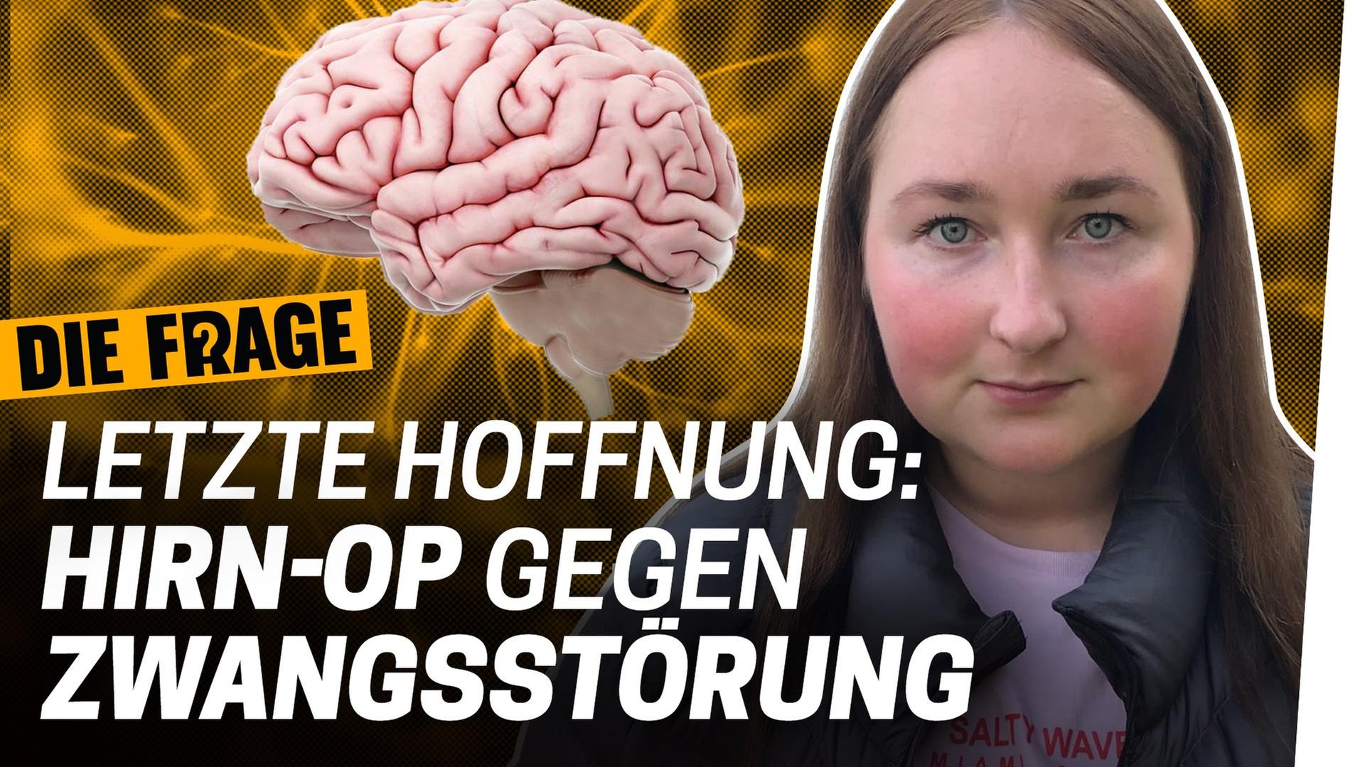 Zwangsstörung: Letzte Hoffnung Hirn-OP