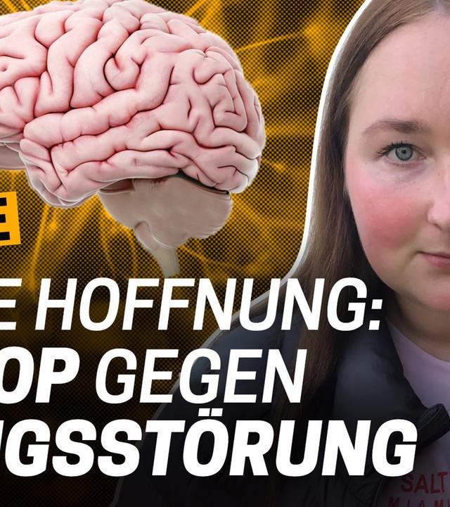Zwangsstörung: Letzte Hoffnung Hirn-OP