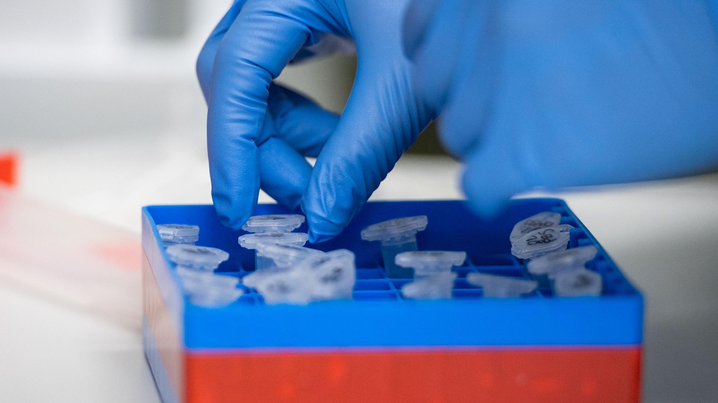 Untersuchungen zum Coronavirus. Archivbild