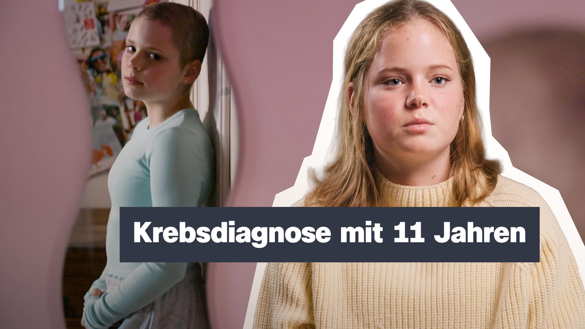 Ein blondes Mädchen im Vordergrund, im Hintergrund ein Bild von dem Mädchen früher mit Glatze