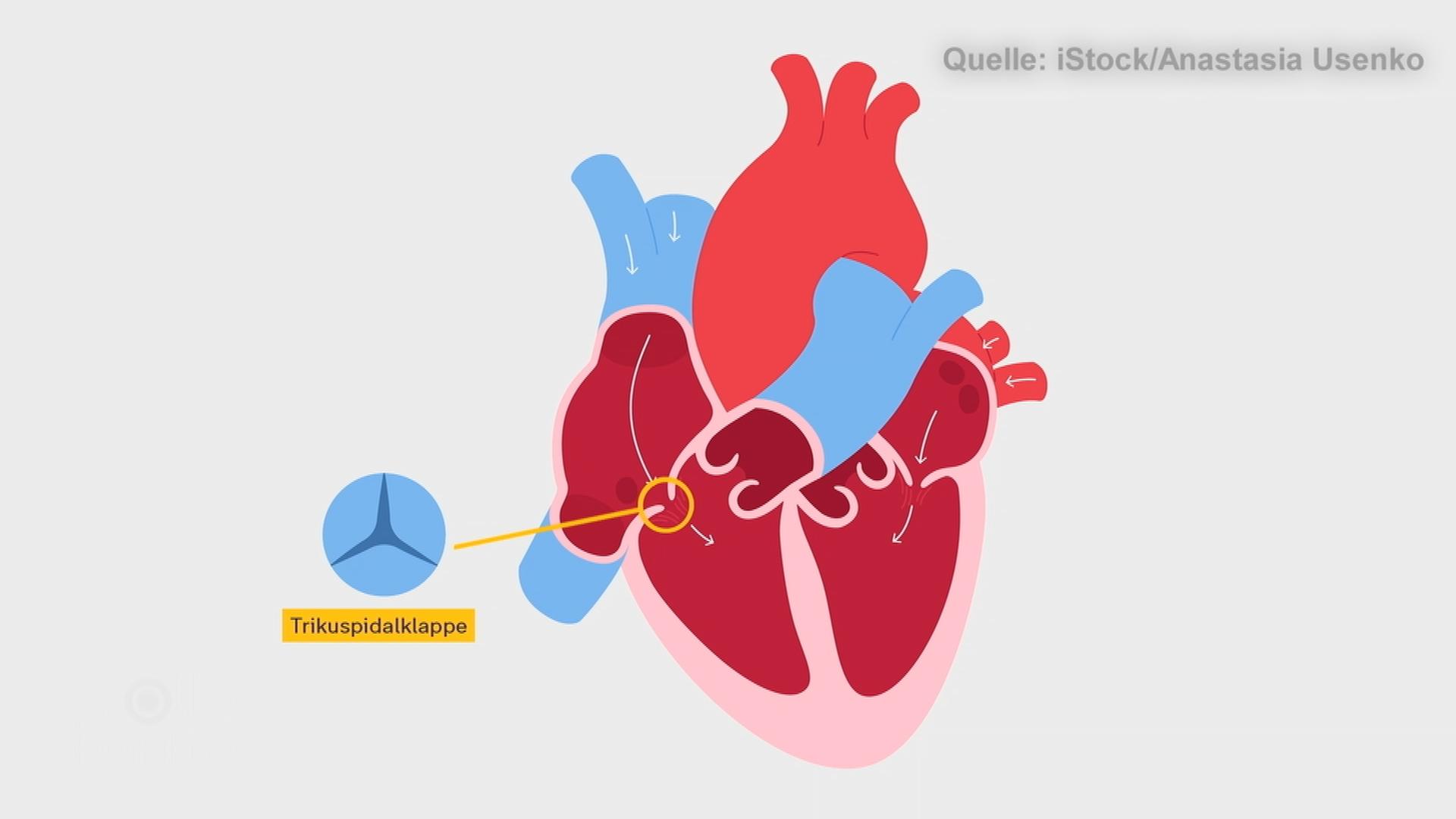Eine visuelle Darstellung des Herzens, in der die Trikuspidalklappe gekennzeichnet ist