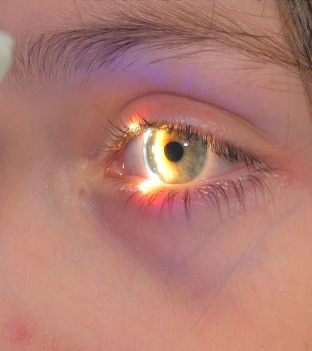 Junge wird mit einem Licht bei einer Untersuchung ins Auge geleuchtet.