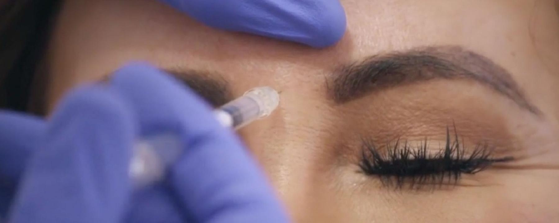  Arzt injiziert Botox zwischen die Augenbrauen einer Frau. Sie hat die Augen geschlossen