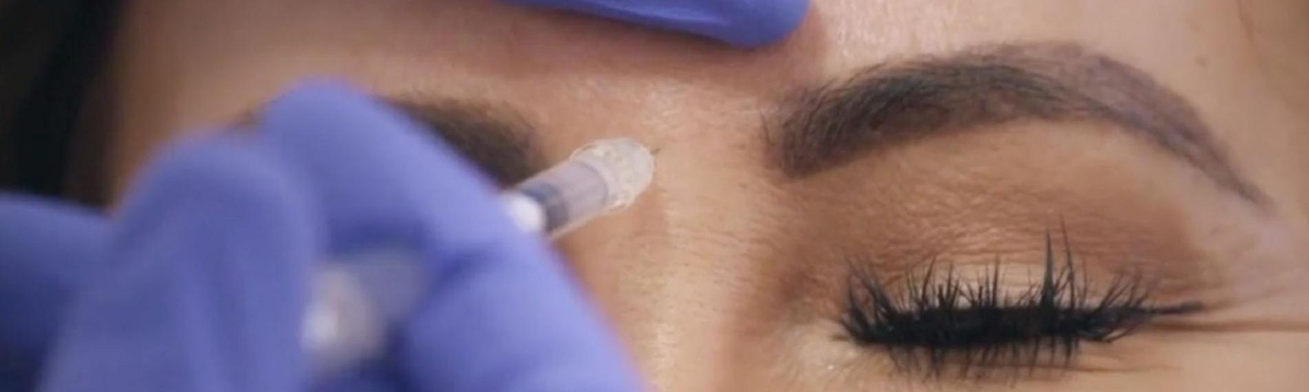  Arzt injiziert Botox zwischen die Augenbrauen einer Frau. Sie hat die Augen geschlossen