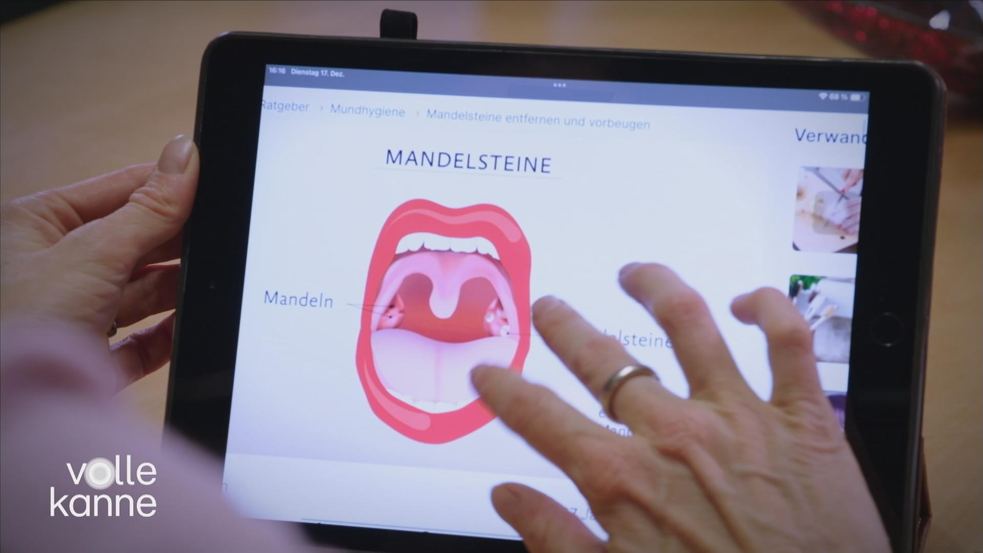 Mandelsteine: selbst entfernen oder nicht?