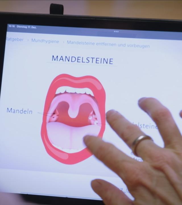 Mandelsteine: selbst entfernen oder nicht?