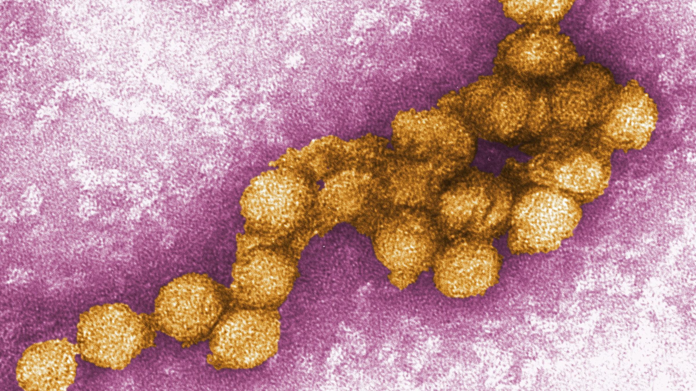 West-Nil-Virus, Archivbild