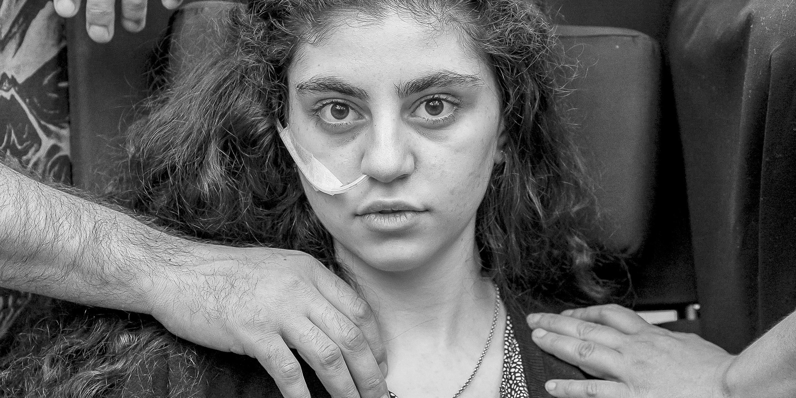 Polen, Podkowa Lesna: Ewa, ein 15-jähriges armenisches Mädchen, das kürzlich aus einem durch das Resignationssyndrom verursachten katatonischen Zustand erwacht ist, sitzt in einem Flüchtlingsaufnahmezentrum in einem Rollstuhl.