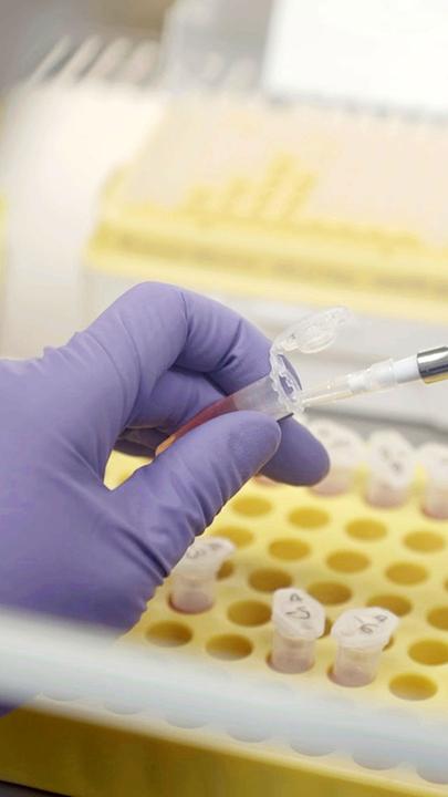 Dr. Estefania Rodríguez füllt mit einer Pipette Flüssigkeit in ein Behältnis.