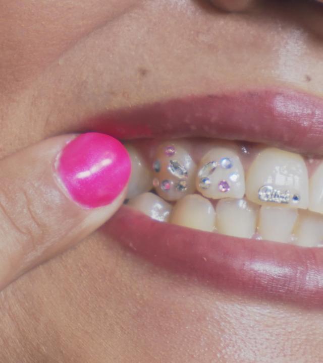 Zahnschmuck aus London